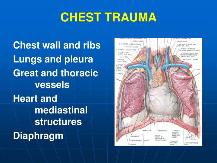 PPT CHEST TRAUMA PowerPoint Presentation ID7083878