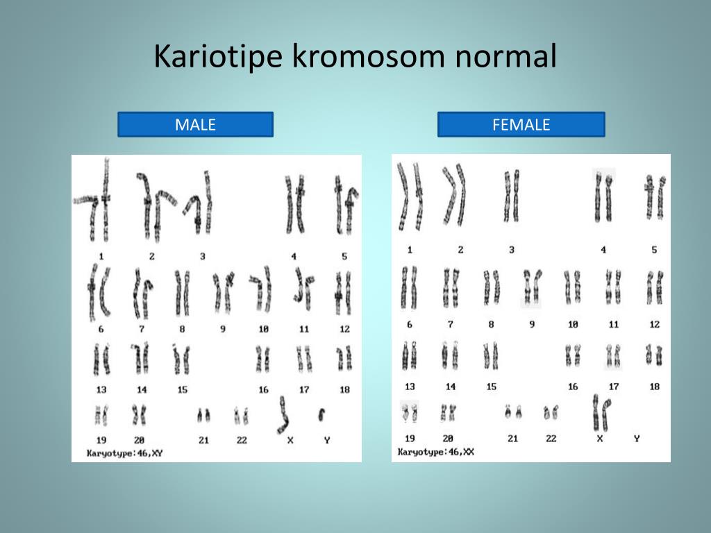 Gambar Diagram Kromosom  Perkawinan Laki  Laki  Dan  Perempuan  