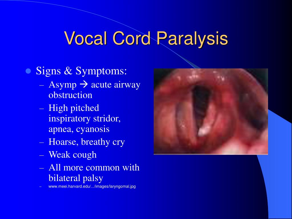 PPT - Differential Diagnosis: Infantile Stridor PowerPoint Presentation