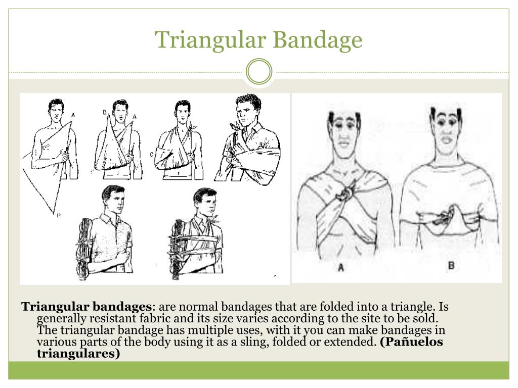 How To Fold A Triangular Bandage Into A Sling At Marisa Johnson Blog