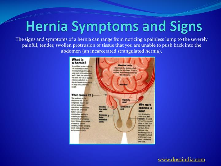 PPT - Doss India - Harnia Treatment in Pune, Maharashtra PowerPoint ...