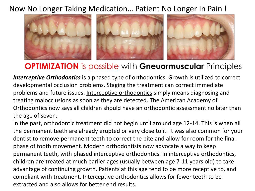 PPT Interceptive Orthodontic Treatment Interceptive orthodonti
